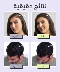 Toppik Hair لفراغات الشعر (اللون اسود) - الصورة 6