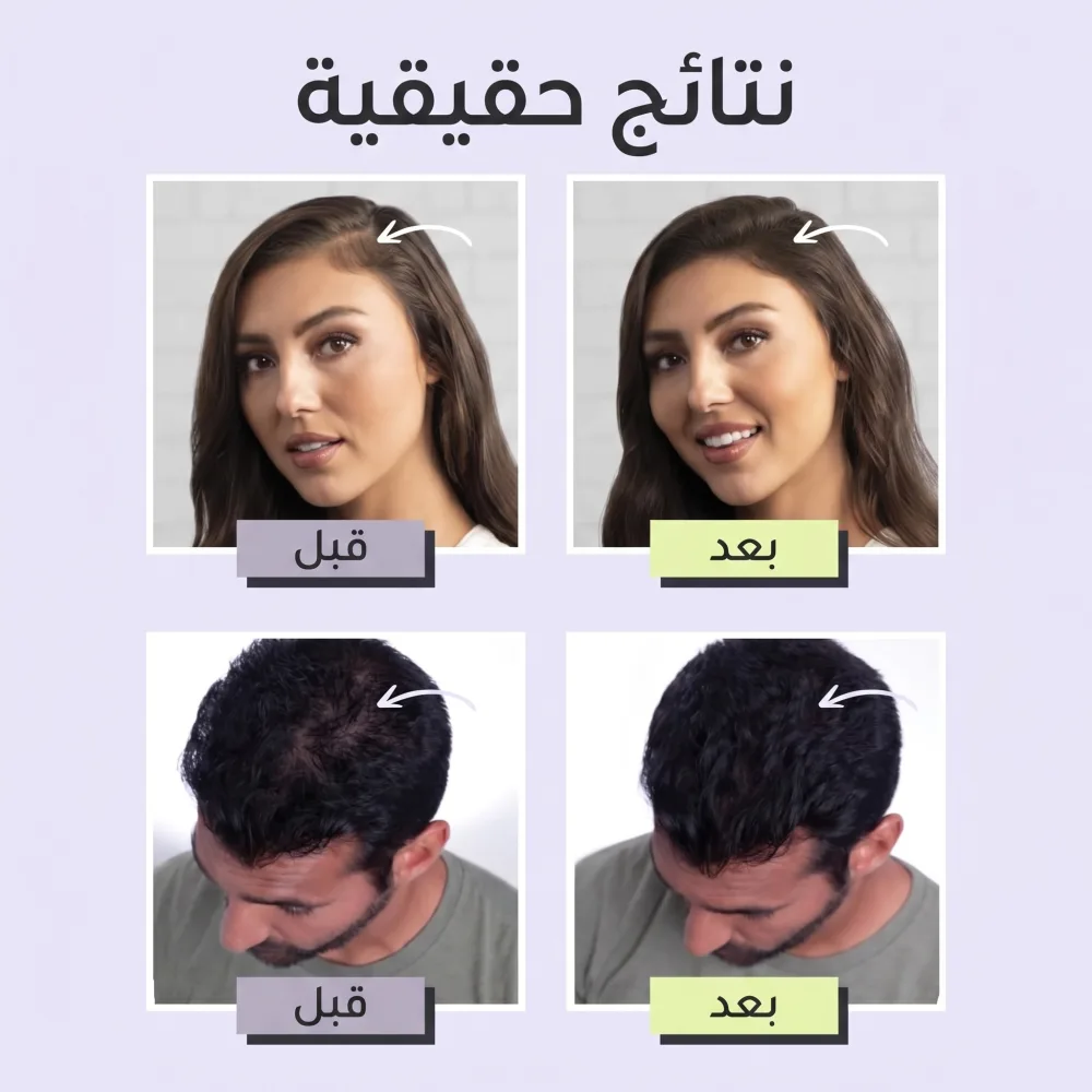 Toppik Hair لفراغات الشعر (اللون اسود) - الصورة 6